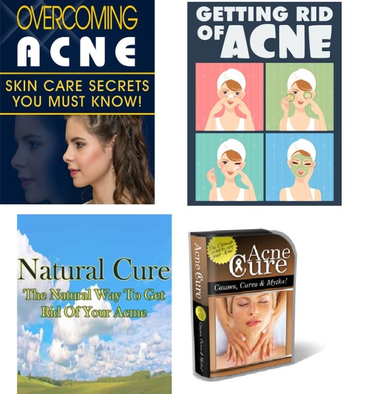 Bundle of Acne Cure, Natural Cure Acne, Getting Rid of Acne and Overcoming Acne